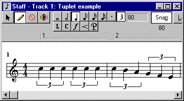 Tuplets in Staff View (4 KB GIF)